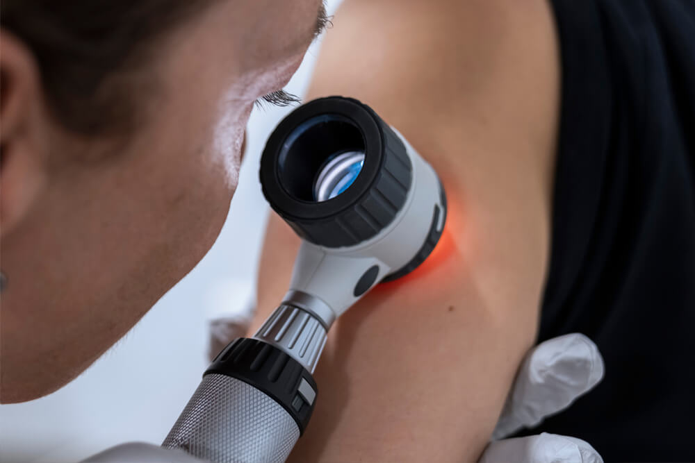 Physician examining patients arm for melanoma symptoms using medical microscope.