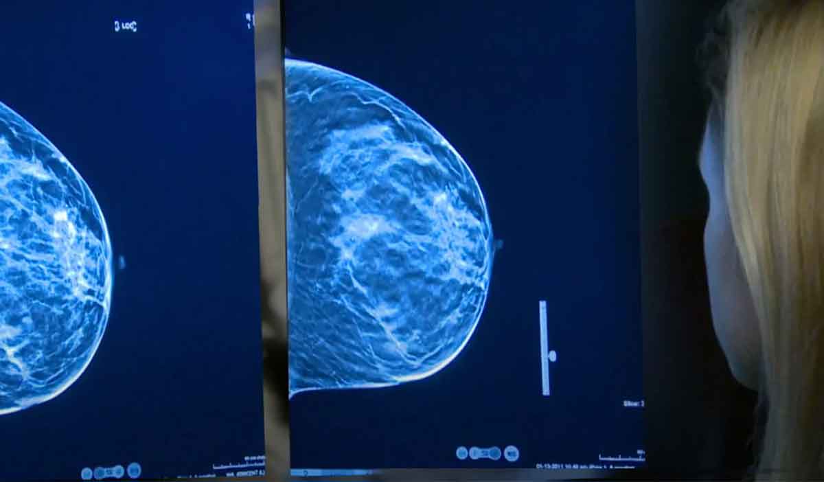 Doctor examines 3D mammograms